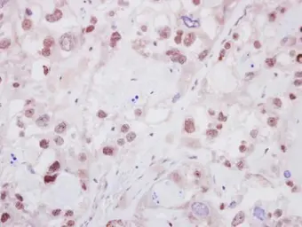 Anti-HELIOS antibody [N3C3] used in IHC (Paraffin sections) (IHC-P). GTX115629