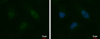 Anti-HELIOS antibody used in Immunocytochemistry/ Immunofluorescence (ICC/IF). GTX115630