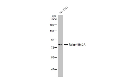 Anti-Rabphilin 3A antibody used in Western Blot (WB). GTX115646