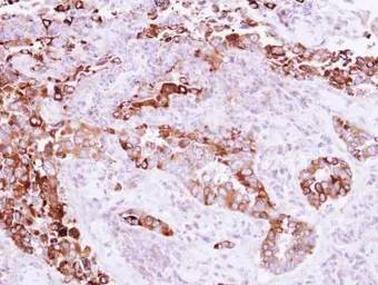Anti-EB3 antibody used in IHC (Paraffin sections) (IHC-P). GTX115652