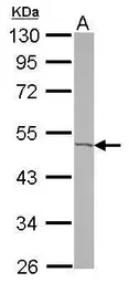 Anti-ACOT9 antibody [N1C1] used in Western Blot (WB). GTX115724