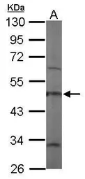Anti-Coronin 1C antibody [C1C3] used in Western Blot (WB). GTX115727