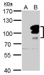 Anti-L3MBTL1 antibody used in Western Blot (WB). GTX115782