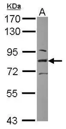 Anti-L3MBTL1 antibody used in Western Blot (WB). GTX115782