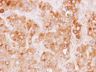 Anti-TRAF3IP1 antibody [N1N2], N-term used in IHC (Paraffin sections) (IHC-P). GTX115798