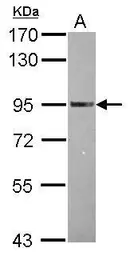 Anti-TRAF3IP1 antibody [N1N2], N-term used in Western Blot (WB). GTX115798