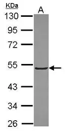 Anti-KLHL3 antibody [N1C1] used in Western Blot (WB). GTX115809