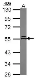 Anti-VPS4A antibody [N3C3] used in Western Blot (WB). GTX115852