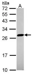 Anti-UBE2S antibody [N1C2] used in Western Blot (WB). GTX115862
