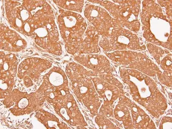 Anti-alpha 3 Catenin antibody [N1N3] used in IHC (Paraffin sections) (IHC-P). GTX115881