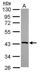 Anti-PSAT1 antibody [N3C3] used in Western Blot (WB). GTX115909