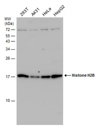Anti-Histone H2B antibody used in Western Blot (WB). GTX115955