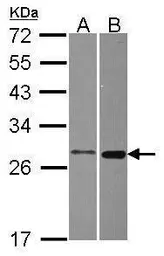 Anti-MTHFS antibody [N1C3] used in Western Blot (WB). GTX115971
