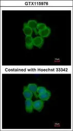 Anti-NMT2 antibody used in Immunocytochemistry/ Immunofluorescence (ICC/IF). GTX115976