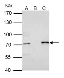 Anti-PRMT5 antibody [N1C1] used in Immunoprecipitation (IP). GTX116004