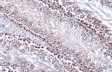 Anti-PRMT5 antibody [N1C1] used in IHC (Paraffin sections) (IHC-P). GTX116004