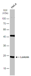 Anti-Loricrin antibody [N1], N-term used in Western Blot (WB). GTX116013