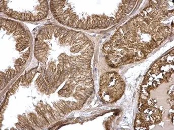 Anti-H-Ras antibody used in IHC (Paraffin sections) (IHC-P). GTX116041