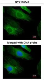 Anti-H-Ras antibody used in Immunocytochemistry/ Immunofluorescence (ICC/IF). GTX116041