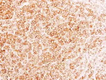 Anti-MRP1 antibody [N1N2], N-term used in IHC (Paraffin sections) (IHC-P). GTX116046