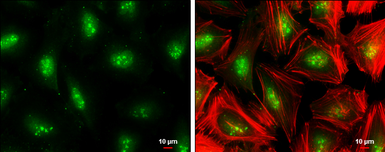 Anti-TCF7L2 antibody used in Immunocytochemistry/ Immunofluorescence (ICC/IF). GTX116056
