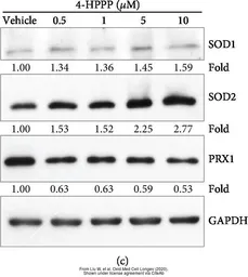 Anti-SOD2 antibody used in Western Blot (WB). GTX116093