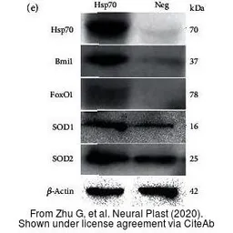Anti-SOD2 antibody used in Western Blot (WB). GTX116093
