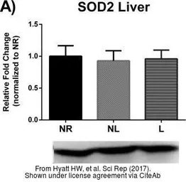 Anti-SOD2 antibody used in Western Blot (WB). GTX116093