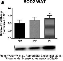 Anti-SOD2 antibody used in Western Blot (WB). GTX116093
