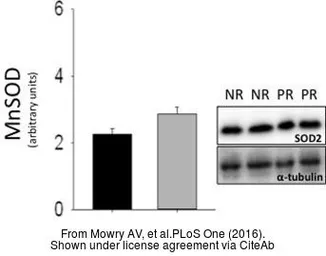 Anti-SOD2 antibody used in Western Blot (WB). GTX116093
