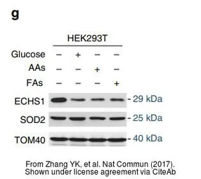 Anti-SOD2 antibody used in Western Blot (WB). GTX116093
