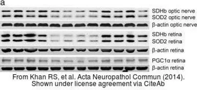 Anti-SOD2 antibody used in Western Blot (WB). GTX116093