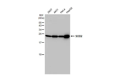 Anti-SOD2 antibody used in Western Blot (WB). GTX116093