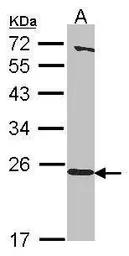 Anti-HEBP1 antibody [N1C3] used in Western Blot (WB). GTX116121