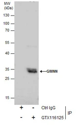 Anti-Geminin antibody used in Immunoprecipitation (IP). GTX116125