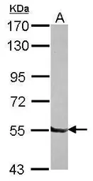 Anti-DBR1 antibody [N1C1] used in Western Blot (WB). GTX116142
