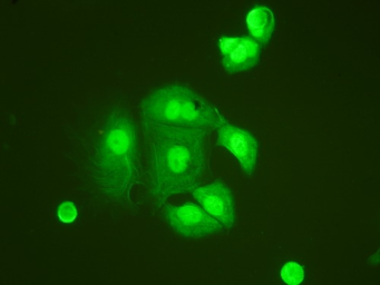 Anti-TNFAIP1 antibody used in Immunocytochemistry/ Immunofluorescence (ICC/IF). GTX11617