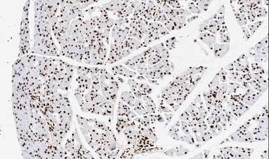 Anti-TNFAIP1 antibody used in IHC (Paraffin sections) (IHC-P). GTX11617