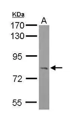 Anti-RC74 antibody [C1C3] used in Western Blot (WB). GTX116266