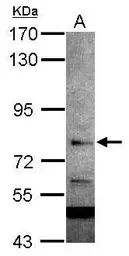 Anti-RC74 antibody [C1C3] used in Western Blot (WB). GTX116266