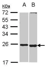 Anti-SOHLH2 antibody [N1C1] used in Western Blot (WB). GTX116268