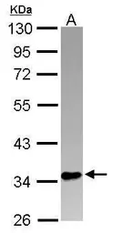 Anti-PINX1 antibody [N1C2] used in Western Blot (WB). GTX116274