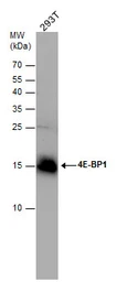 Anti-4E-BP1 antibody [N1C3-2] used in Western Blot (WB). GTX116315