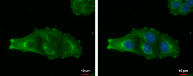 Anti-MAGEA4 antibody used in Immunocytochemistry/ Immunofluorescence (ICC/IF). GTX116357