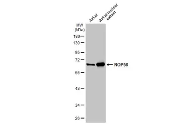 Anti-NOP58 antibody [N1N3] used in Western Blot (WB). GTX116419