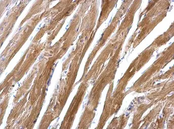 Anti-SGCE antibody [N1C1] used in IHC (Paraffin sections) (IHC-P). GTX116453