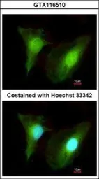 Anti-SMYD2 antibody used in Immunocytochemistry/ Immunofluorescence (ICC/IF). GTX116510