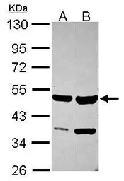 Anti-SMYD2 antibody used in Western Blot (WB). GTX116510