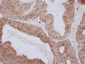 Anti-PNPase antibody used in IHC (Paraffin sections) (IHC-P). GTX116542