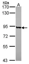 Anti-PNPase antibody used in Western Blot (WB). GTX116542